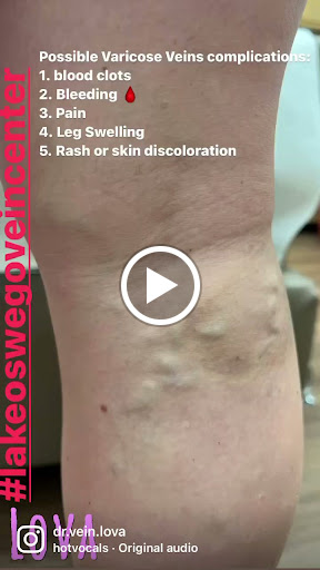 Explore tattoo ideas men, creative tattoo ideas in Lake Oswego, available at Lake Oswego Vein and Aesthetic LOVA