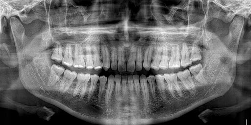 Imagen Dental Radiográfica