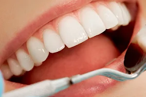 Οδοντιατρική Κλινική Μαυρογένης, Οδοντικά Εμφυτεύματα / Mavrogenis Dental Clinic, Implants image