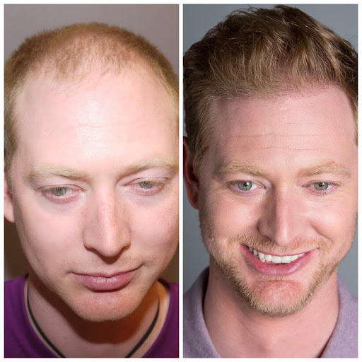 Hair Transplantation Clinic «Bosley Medical - Seattle», reviews and photos, 2505 2nd Ave #715, Seattle, WA 98121, USA