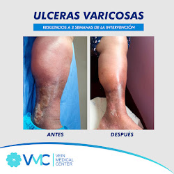 Vein Medical Center- Dra. Cindy Vásquez