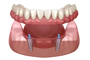 Chahar Dental Clinic & Implant center image