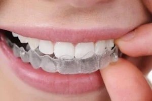 Simalti Dental Clinic Orthodontic And Implant Centre image