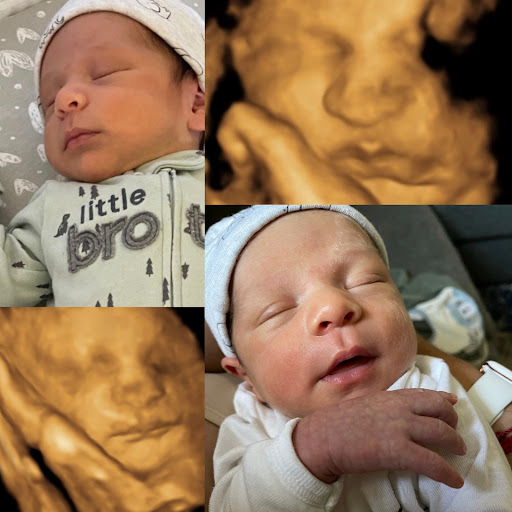 A Little Insight 3D 4D 5D Ultrasound image