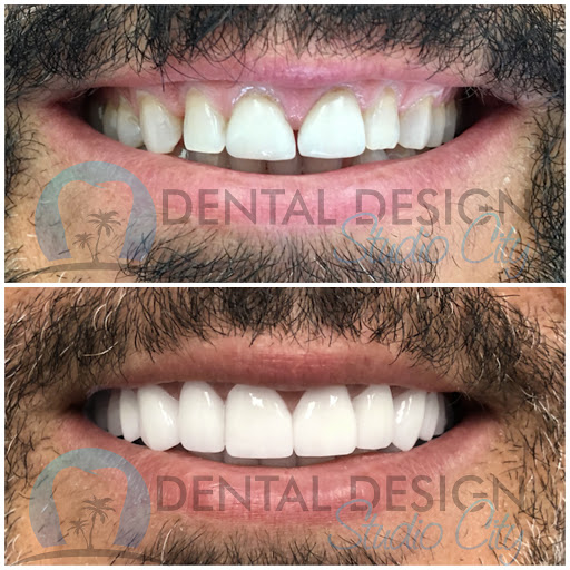 Dental Design Studio City image