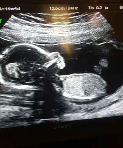 Baby Envision 4D Ultrasound of Troy image 3