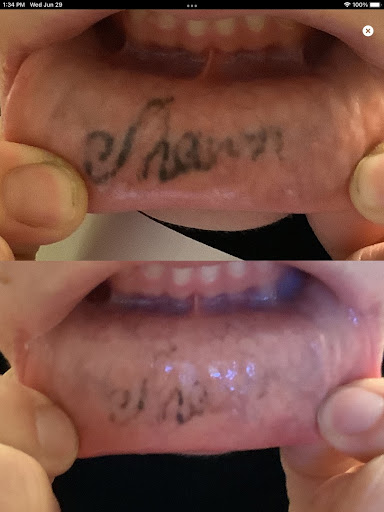Explore trapped tattoo ideas, creative tattoo ideas in Wenatchee, available at Valley Laser & Skin (Hablamos Espaol) - Wenatchee