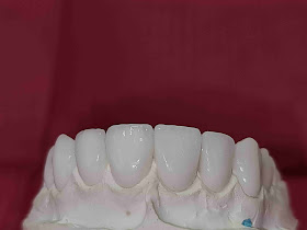 Clinica de Stomatologie Craiova - Premium Estetic Dental- specializata pe implaturi, fatete dentare , zirconiu