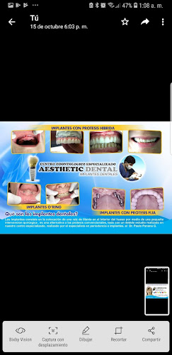Opiniones de Aesthetic Dental - Implantes Dentales en Huacho - Dentista