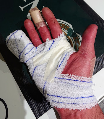 Docteur Iskander Djerbi chirurgien de la main et de l'épaule à Saint-Jean
