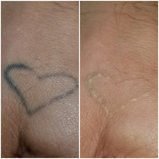 Explore black and white sleeve tattoo ideas, creative tattoo ideas in Houston, available at Htown Lasers