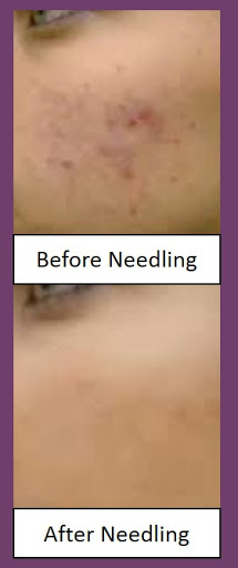 Explore small tattoo ideas for men's, creative tattoo ideas in Bellevue, available at Caddells Laser & Electrolysis Clinic, Inc.