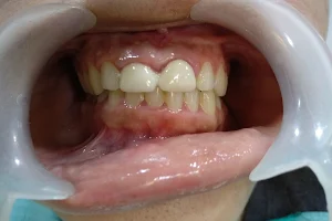 Smiles For All Dental Clinic And Children Dental Care: Dr. Ganesha M Bopal Ghuma South Bopal image