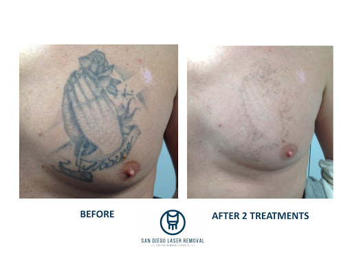 Explore under butt tattoo ideas, creative tattoo ideas in San Diego, available at Removery Tattoo Removal & Fading