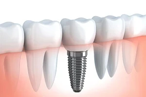Dantam Dental Clinic- Dr.Nishant ratanpara image