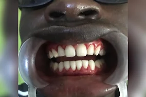 Teeth Clinic Akure Queen Elizabeth Dental Services image