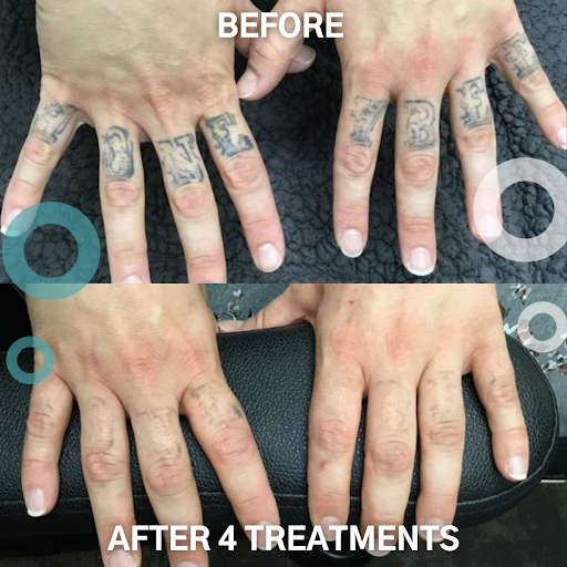 Explore full neck tattoo ideas for men, creative tattoo ideas in San Jose, available at Removery Tattoo Removal & Fading