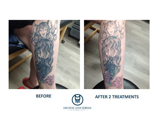 Explore aviation tattoo ideas, creative tattoo ideas in San Diego, available at Removery Tattoo Removal & Fading