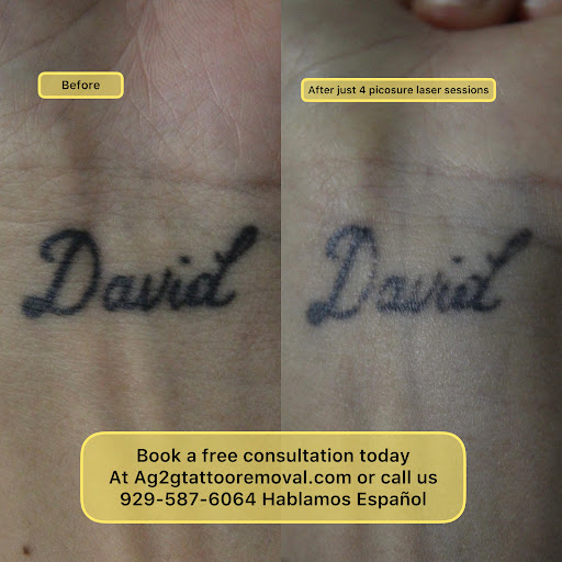 Find best tattoo ideas for wrist for your next unique tattoo in New York at Ag2g Laser Tattoo Removal & MedSpa