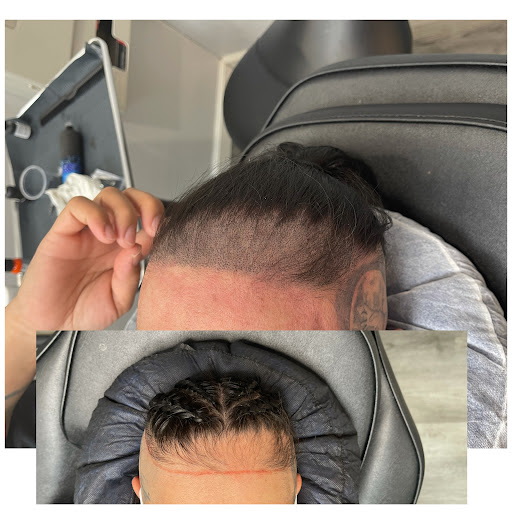 Explore stomach tattoo ideas, creative tattoo ideas in Roseville, available at NuHair Ink. Scalp MicroPigmentation & Aesthetic Clinic of Sacramento