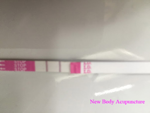 New Body Acupuncture image