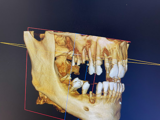 Clínica ZeroDental en Guadalajara, Guadalajara