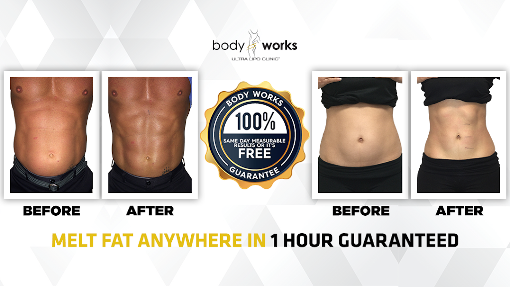 Body Works Ultra Lipo Clinic McAllen, TX 78504 Services and Reviews