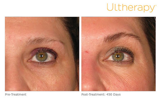 Medical Spa «Pur Skin Clinic», reviews and photos, 307 Bell St #104, Edmonds, WA 98020, USA