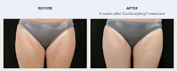SKINovative - Photo 4 - Car repair in Gilbert, AZ, Chandler
