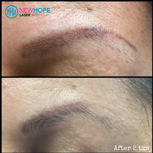 Explore tattoo ideas brothers, creative tattoo ideas in Westminster, available at Newhope Laser Skin Care