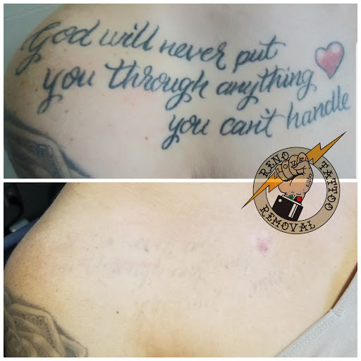 Explore rose tattoo ideas for men, creative tattoo ideas in Reno, available at Reno Tattoo Removal