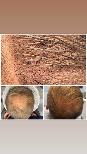 Explore small back tattoo ideas, creative tattoo ideas in Roseville, available at NuHair Ink. Scalp MicroPigmentation & Aesthetic Clinic of Sacramento