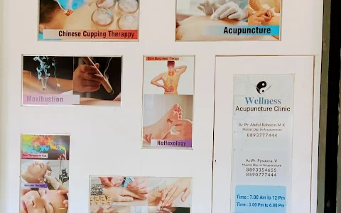 Wellness Acupuncture Clinic - Acupuncture clinic in kochi-best acupuncture clinic-sujok image