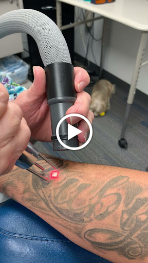 Explore st louis tattoo ideas, creative tattoo ideas in San Antonio, available at South West Tattoo Removal Program