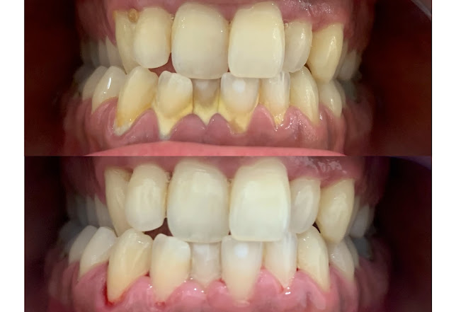 Smartsmile - οδοντιατρείο Έρρικα Σαριδάκη - Οδοντίατρος