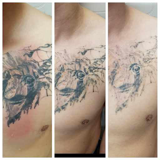 Explore firefighter tattoo ideas, creative tattoo ideas in Louisville, available at Removery Tattoo Removal & Fading