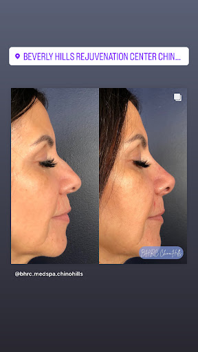 Beverly Hills Rejuvenation Center image