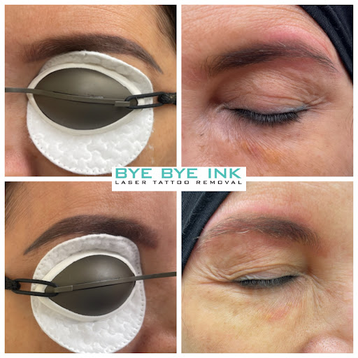 Explore phases of the moon tattoo ideas, creative tattoo ideas in Middle Village, available at Bye Bye Ink Laser Tattoo Removal