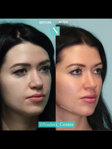 The Naderi Center for Plastic Surgery & Dermatology