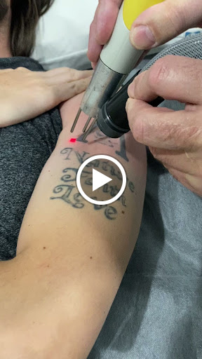 Explore jester tattoo ideas, creative tattoo ideas in Naples, available at Laser Tattoo Removal Services