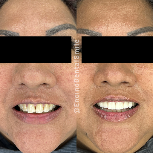 Encino Dental Smile image