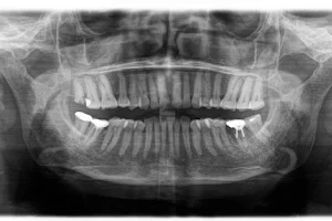 Signature Smile Dental Spa image