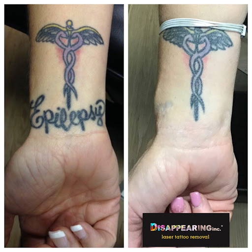 Explore ideas for leg tattoos, creative tattoo ideas in Mineola, available at Removery Tattoo Removal & Fading