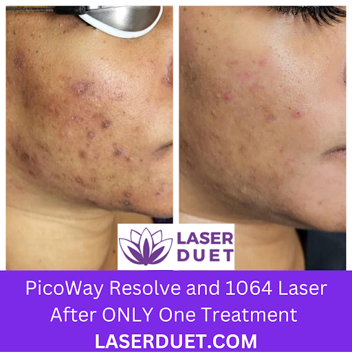 Explore hand tattoo ideas for men, creative tattoo ideas in Dearborn, available at Laser Duet Med Spa