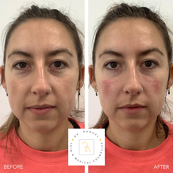 دكتور راكيل للبشرة ومستحضرات التجميل الطبية - Dr Raquel Skin & Medical Cosmetics