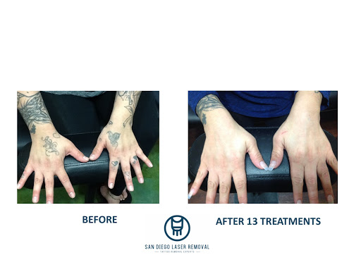 Explore marigold tattoo ideas, creative tattoo ideas in San Diego, available at Removery Tattoo Removal & Fading