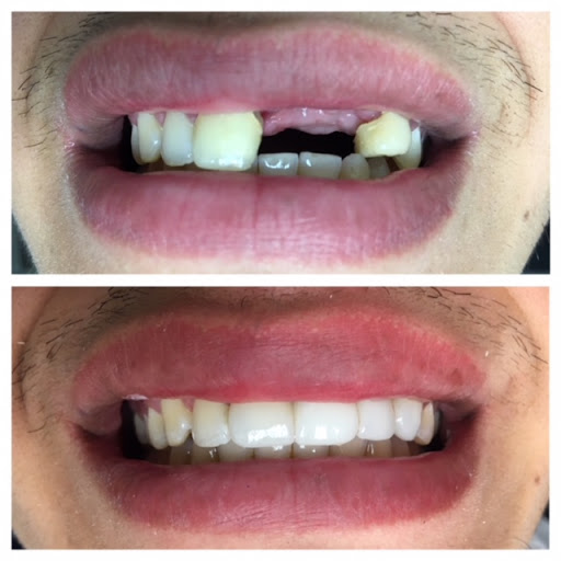 PhD Dental of Lynwood Adults, Kids, Implants & Orthodontics image