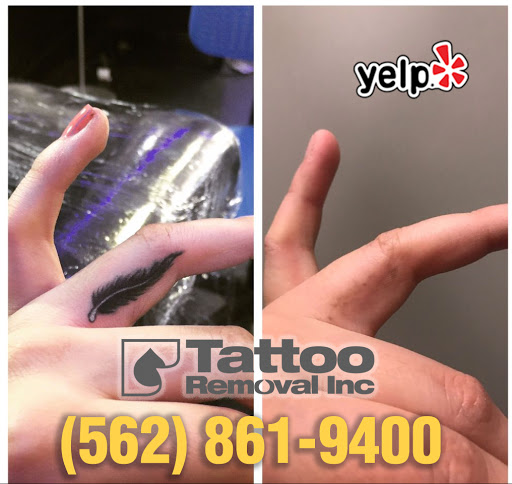Explore civil war tattoo ideas, creative tattoo ideas in South Gate, available at Tattoo Removal Inc