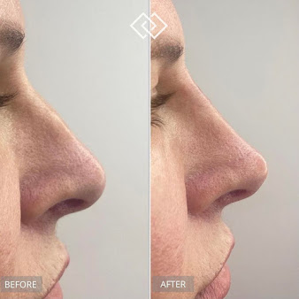 Australian Laser and Skin Clinics - Ringwood - Australian Laser and Skin Clinics - Ringwood