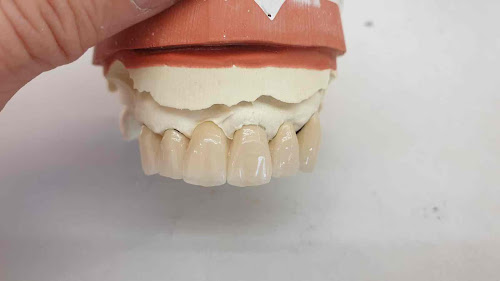 Centre de prothèses dentaires D.G. Protheses Dentaires Saint-Cyprien